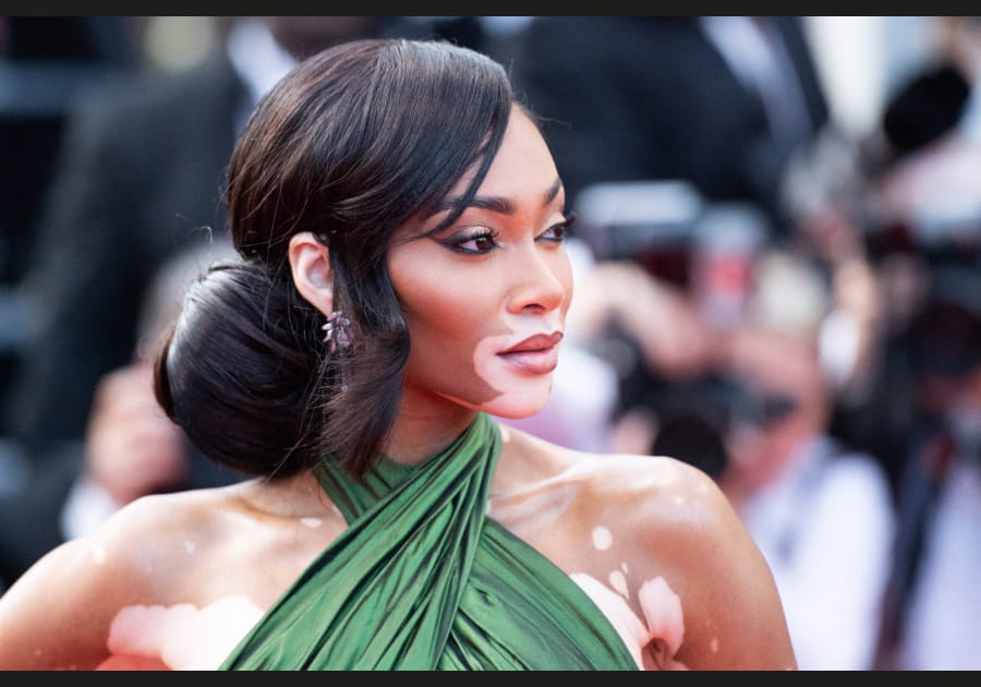 Winnie Harlow, &eacute;l&eacute;gante avec son chignon side hair