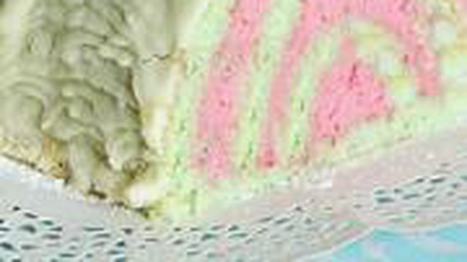 Bûche choco framboise pistache et chocolat blanc