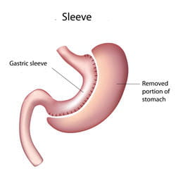 sleeve.
