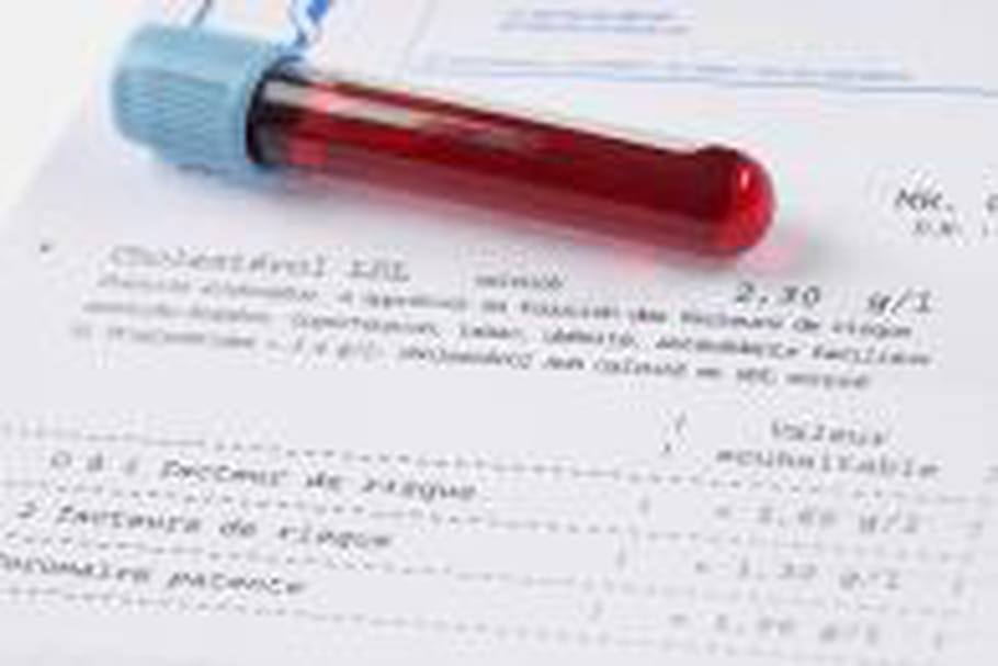 Diagnostic biologique de l'hépatite C