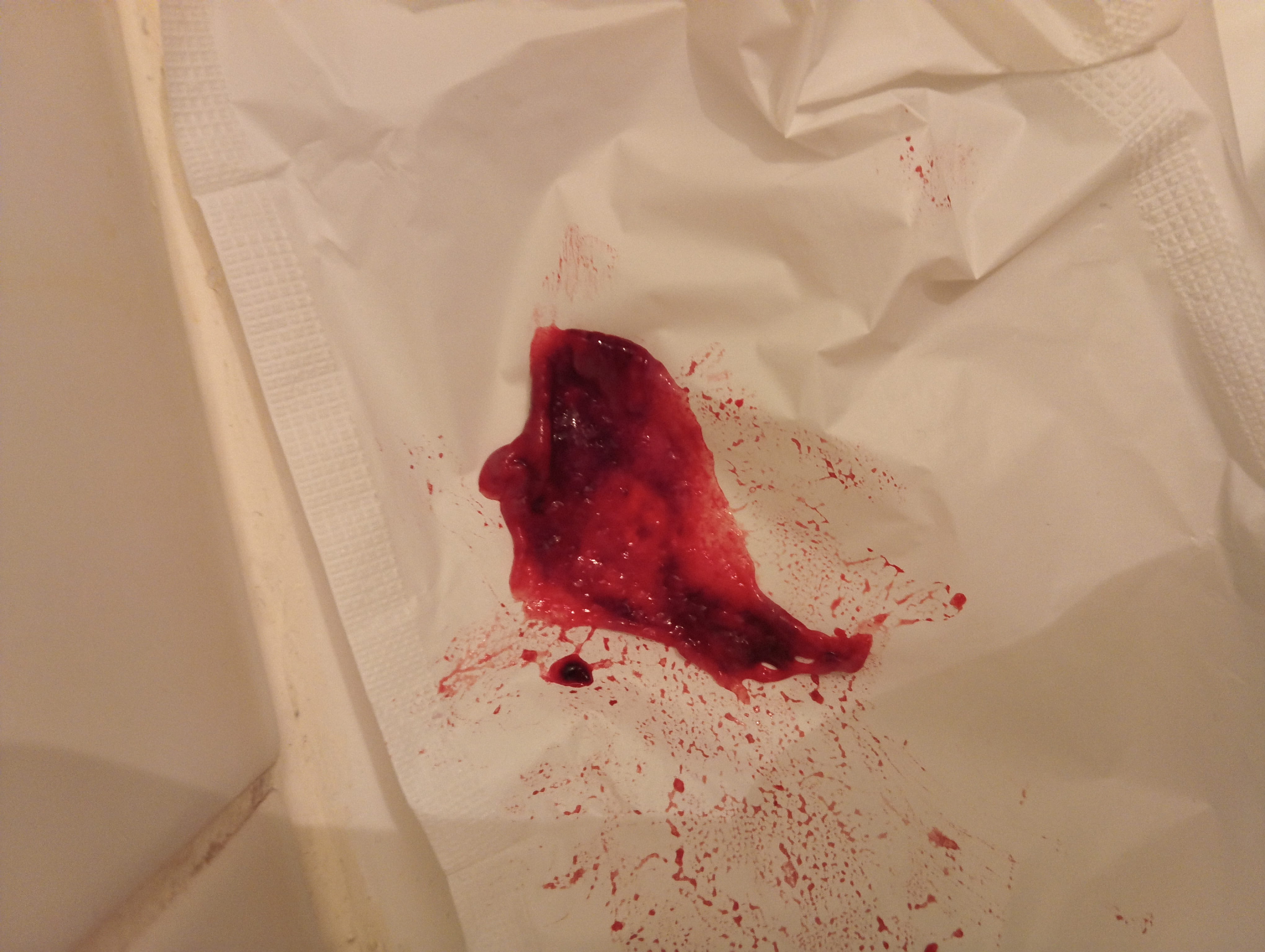 J'ai perdu ce truc pandans la grossesse