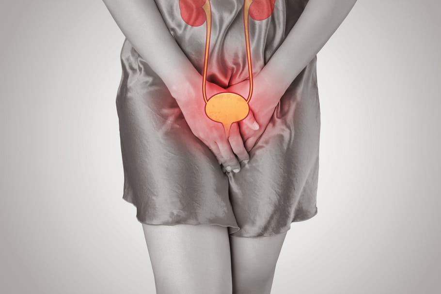 Ablation de la vessie (cystectomie) : indication, déroulé, conséquences
