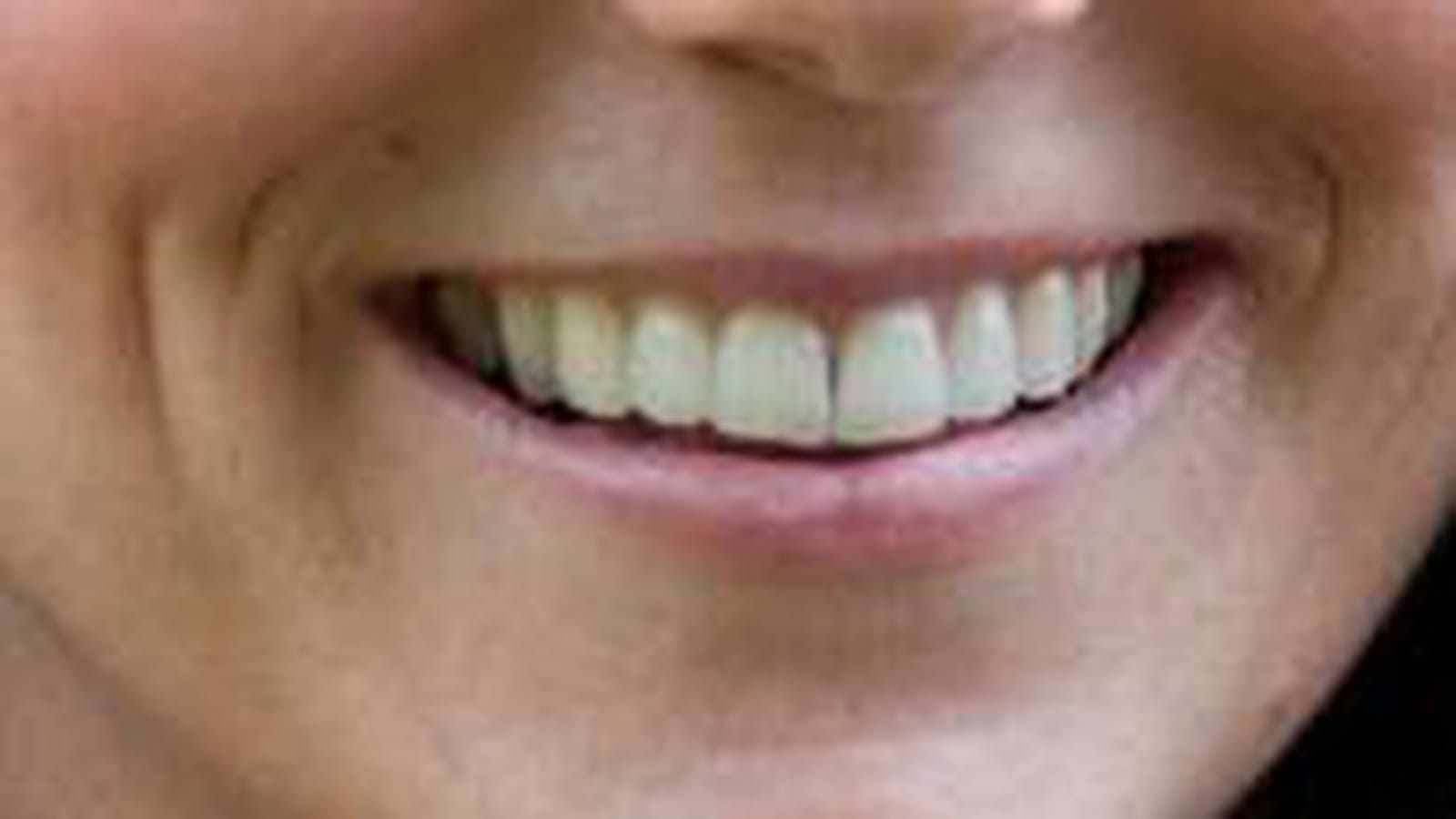 Joli sourire ?