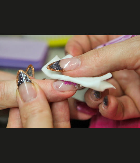 La stabilisation de l'ongle