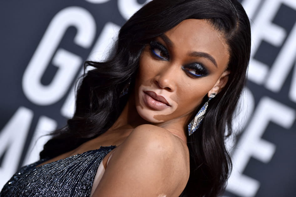 Winnie Harlow et son regard bleu intense