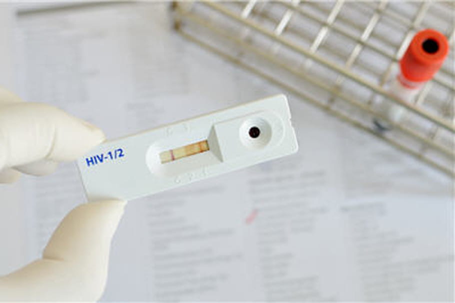 Sida : les autotests de dépistage disponibles en pharmacie en juillet 2015
