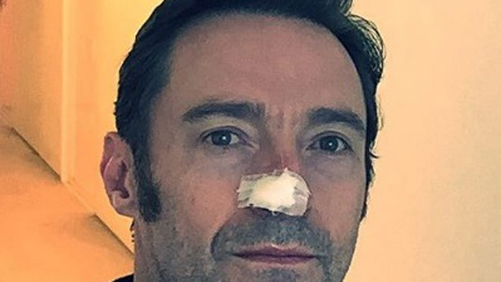 Hugh Jackman