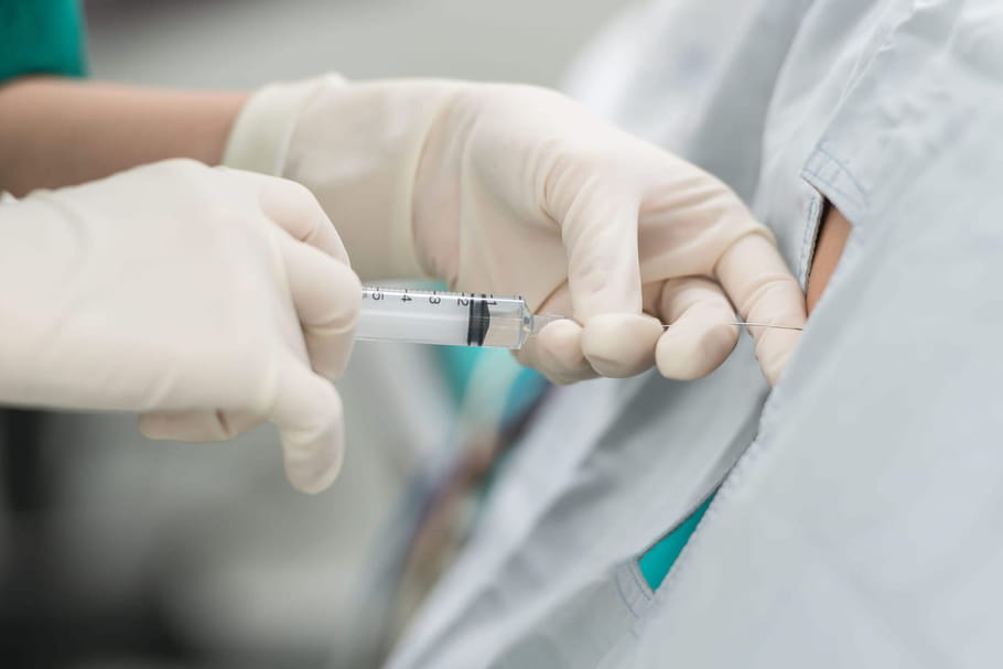 Péridurale : anesthésie, quand la demander, quels risques ?
