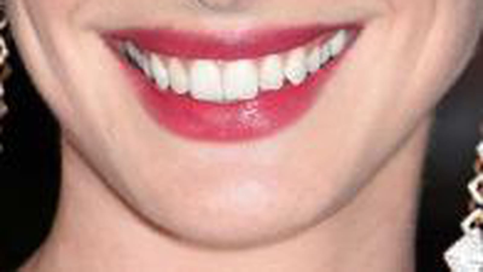 Sourire glamour 