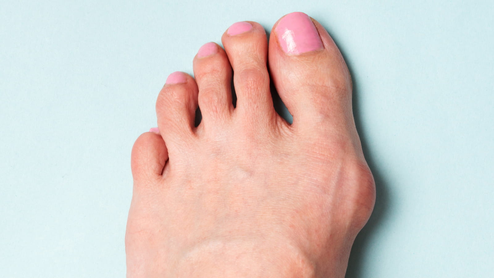 Ce qui déforme les pieds