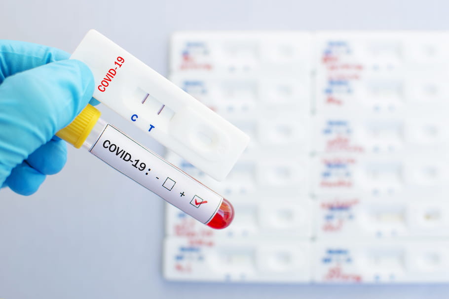 Test coronavirus sérologique, PCR, où le faire, avec une ordonnance