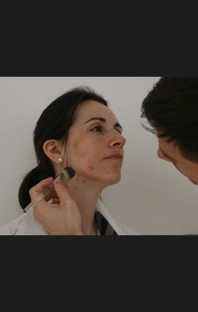 Camoufler ses boutons&nbsp;: l'hydratation du visage