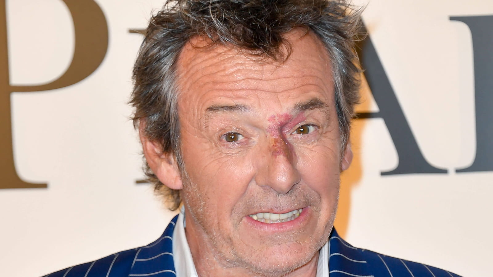 Jean-Luc Reichmann