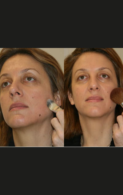 Comment cacher les rougeurs du visage&nbsp;: le fond de teint