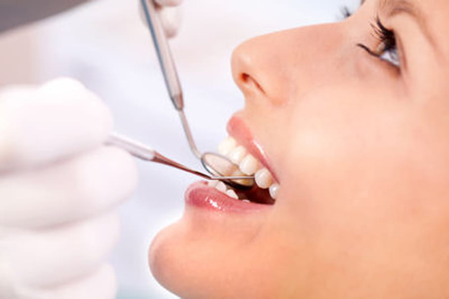 Le bisphénol A abîmerait l'émail des dents
