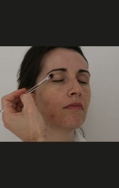 Camoufler ses boutons&nbsp;: illuminer le regard