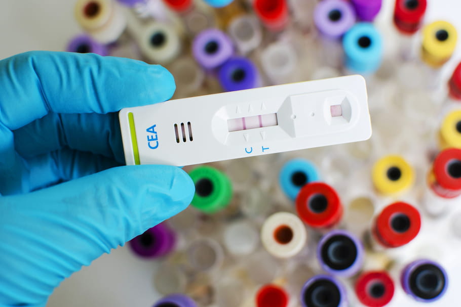 Dosage de l'antigène carcinoembryonnaire (ACE) les valeurs normales