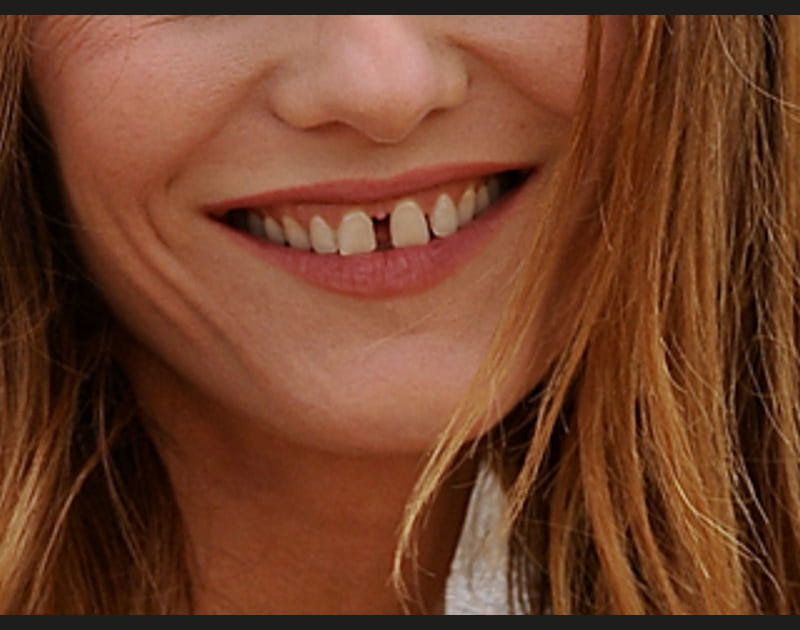 A qui est ce sourire avec les dents du bonheur ?